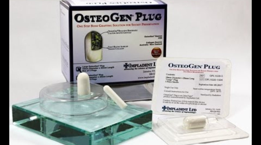 03. OsteoGen Plug Product Overview